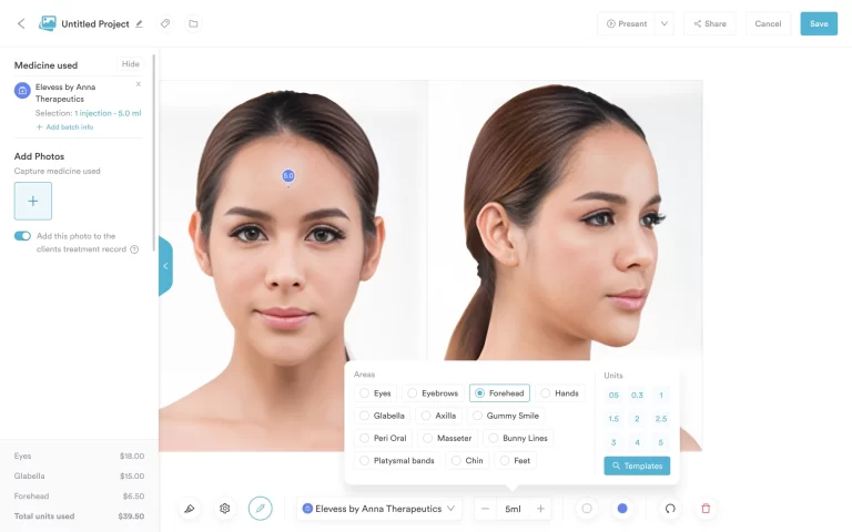 Pabau injection plotting interface showing facial treatment points with dosage tracking
