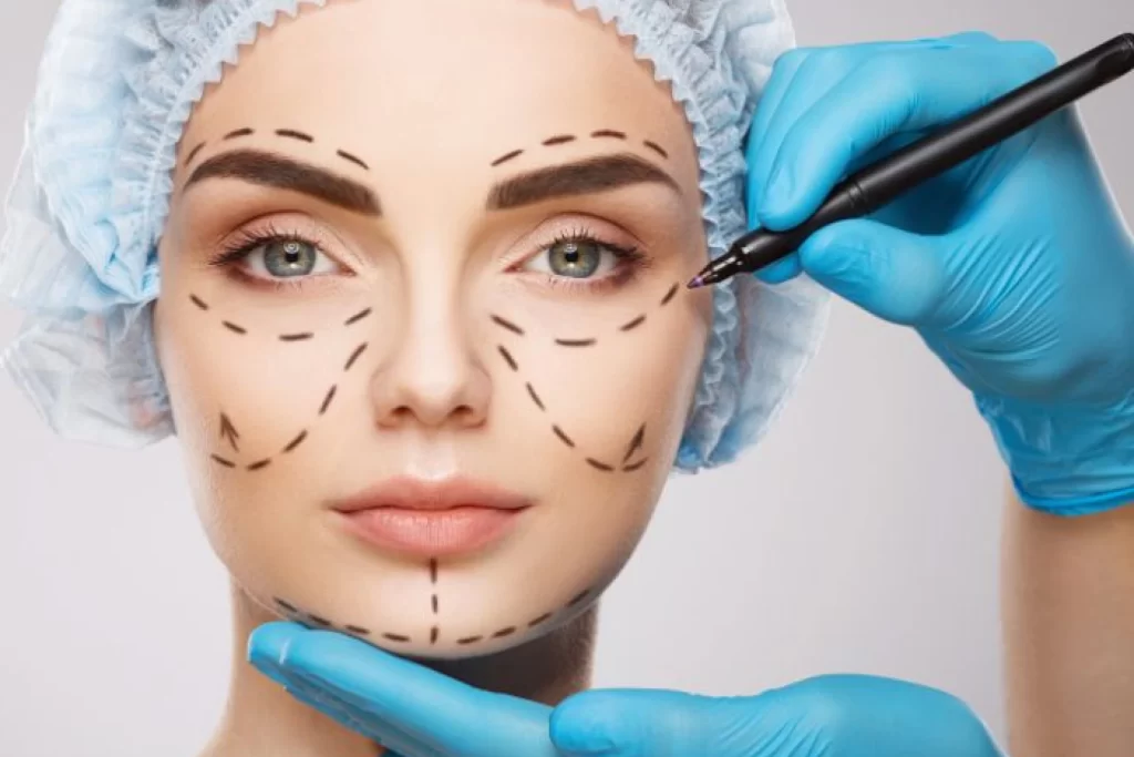 Filler face mapping: Guide and template for med spas