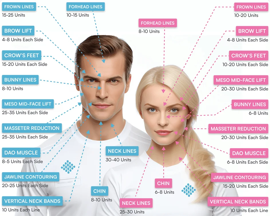 Botox face mapping face units