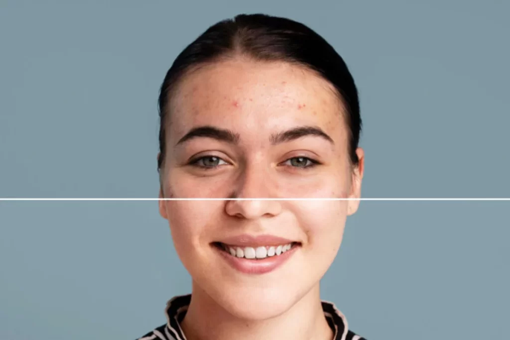 The power of med spa before and after photos with Pabau