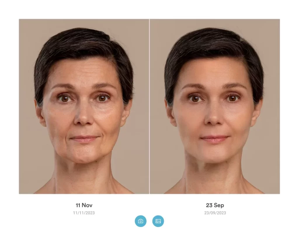 Before-and-after-images