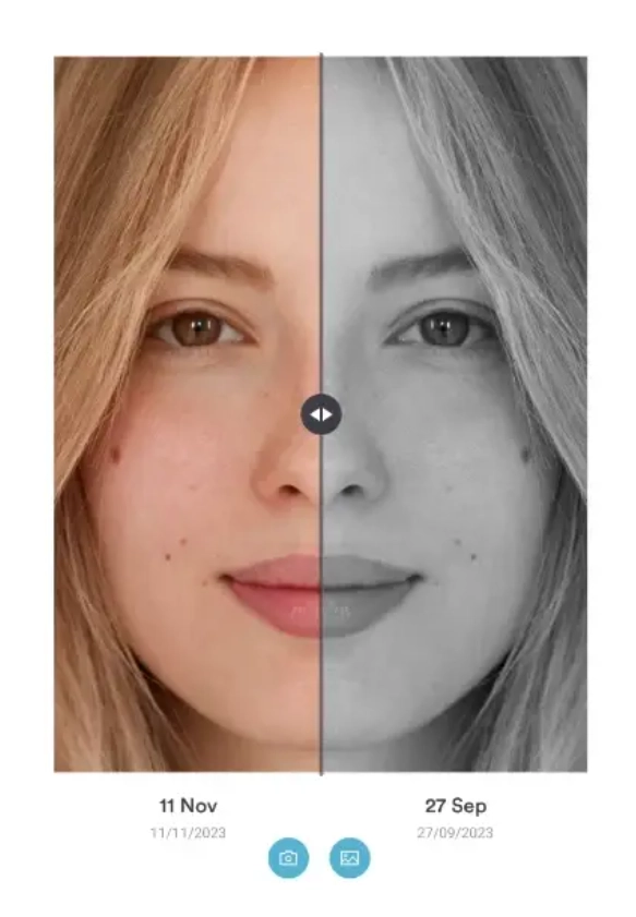 Pabau before and after photo management for weight loss progress tracking