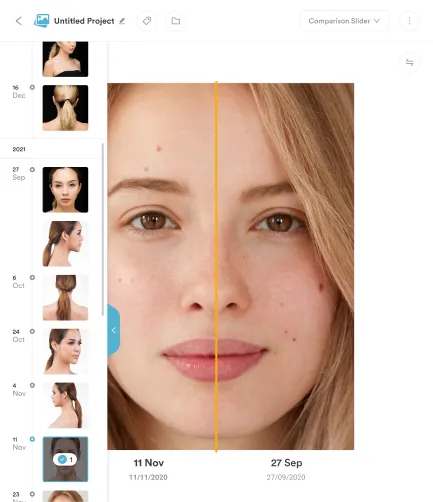 Before-and-after photos in Pabau