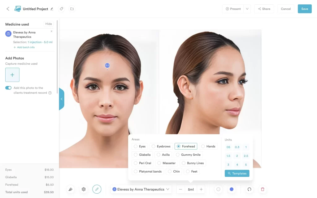 Injection plotting in Pabau