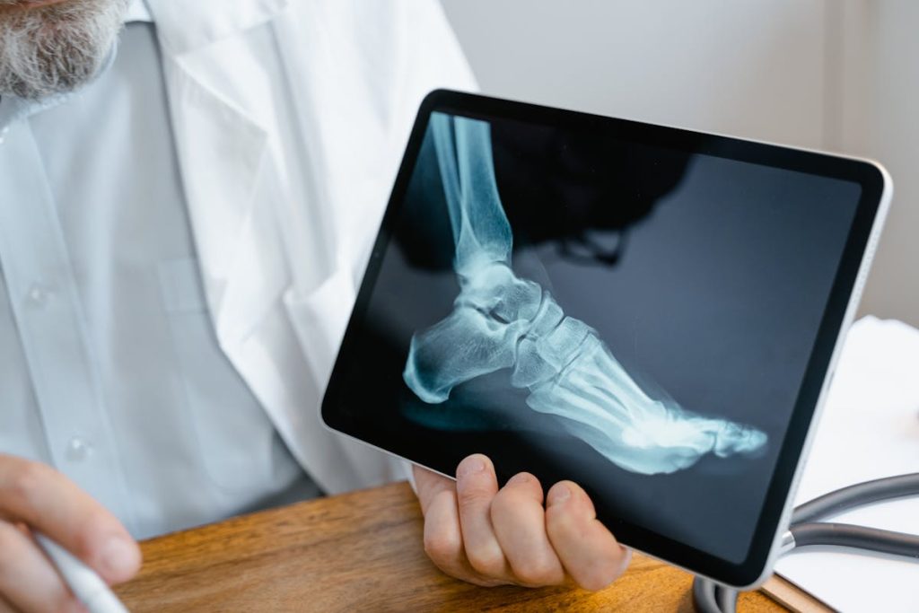 Ottawa ankle rules calculator examination of foot and ankle injury