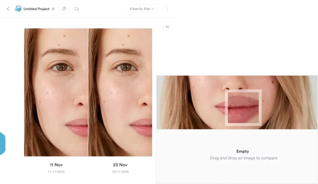 Before and after photo Pabau