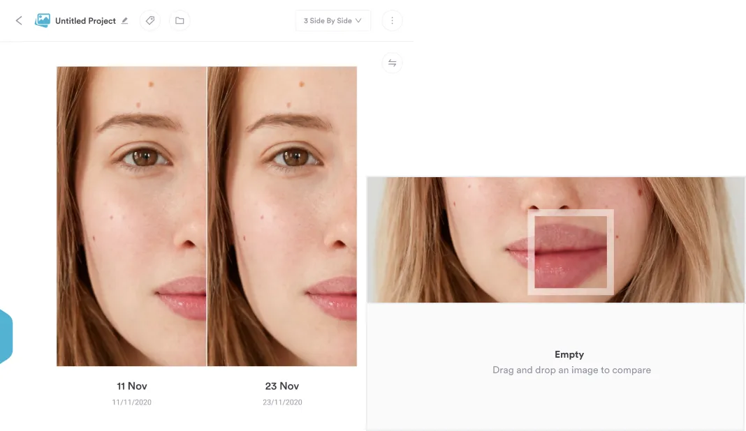 Before-and-after patient photo comparison inside a Pabau client record