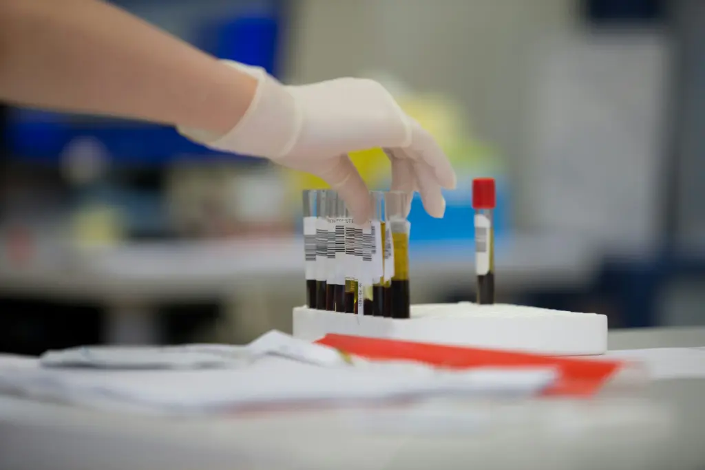 lab technician sorts through vials for blood test
