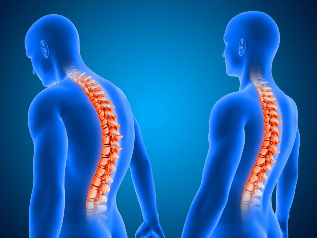 Featured image for the NEXUS criteria cervical spine clearance guide