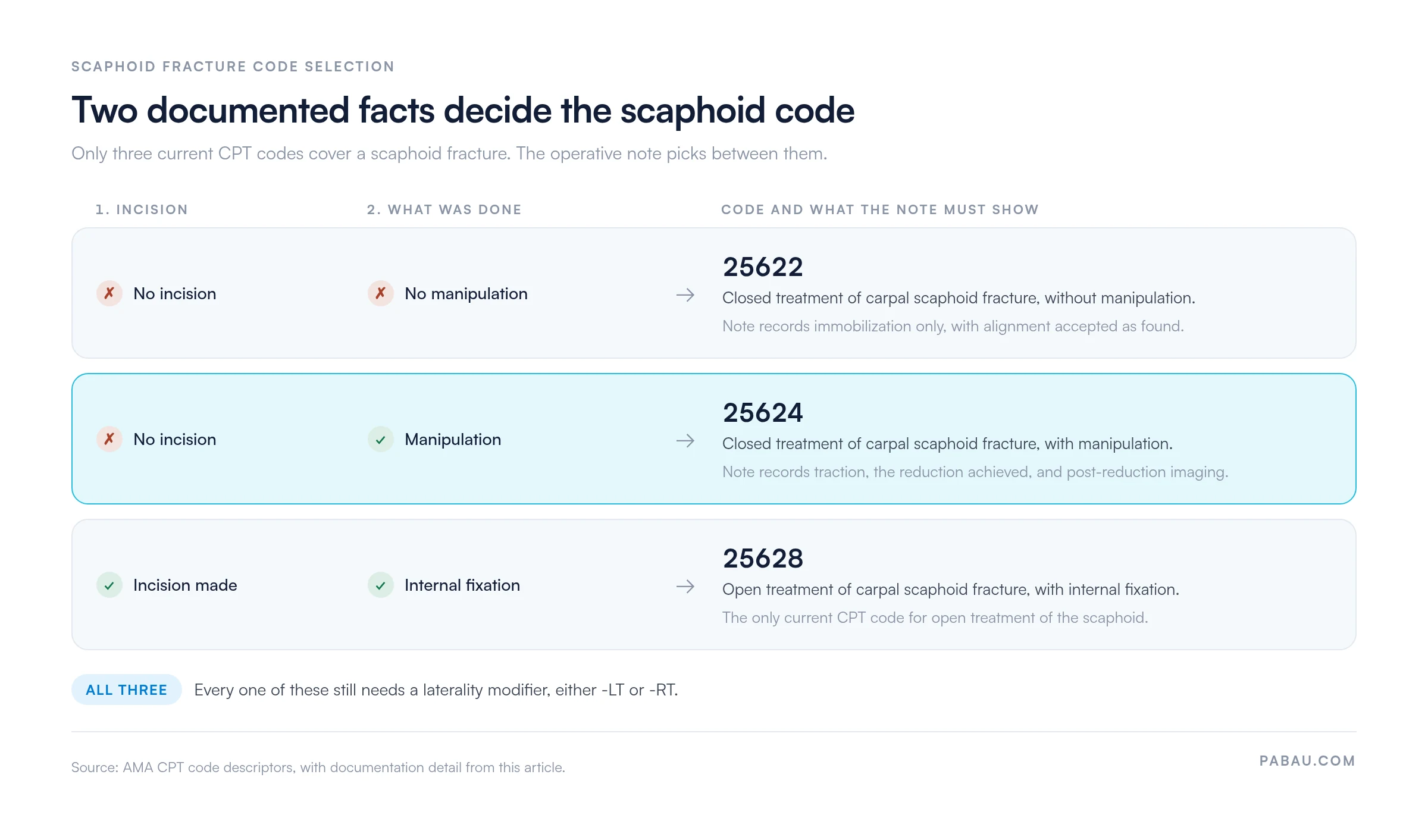 Decision chart for scaphoid fracture CPT codes: no incision and no manipulation is 25622, no incision with manipulation is 25624, incision with internal fixation is 25628, and all three need an -LT or -RT laterality modifier