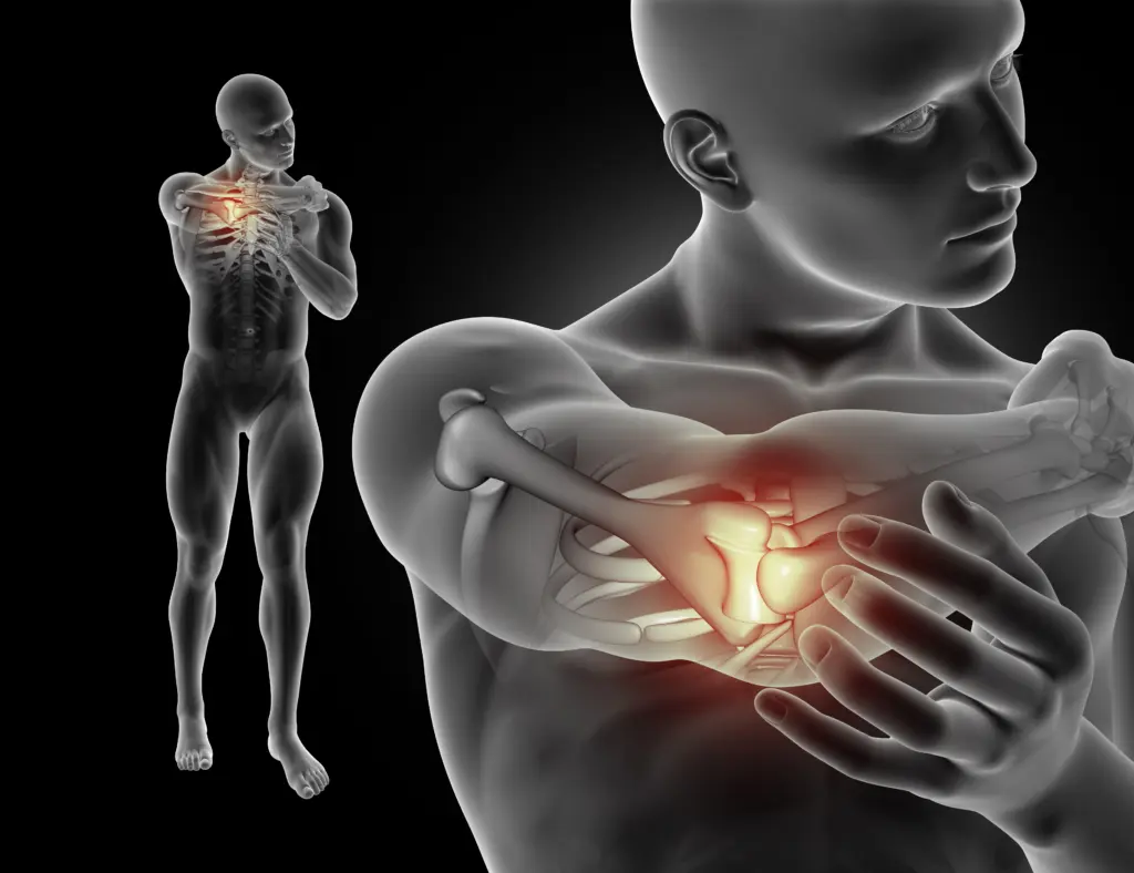 3D male figure with elbow pain.