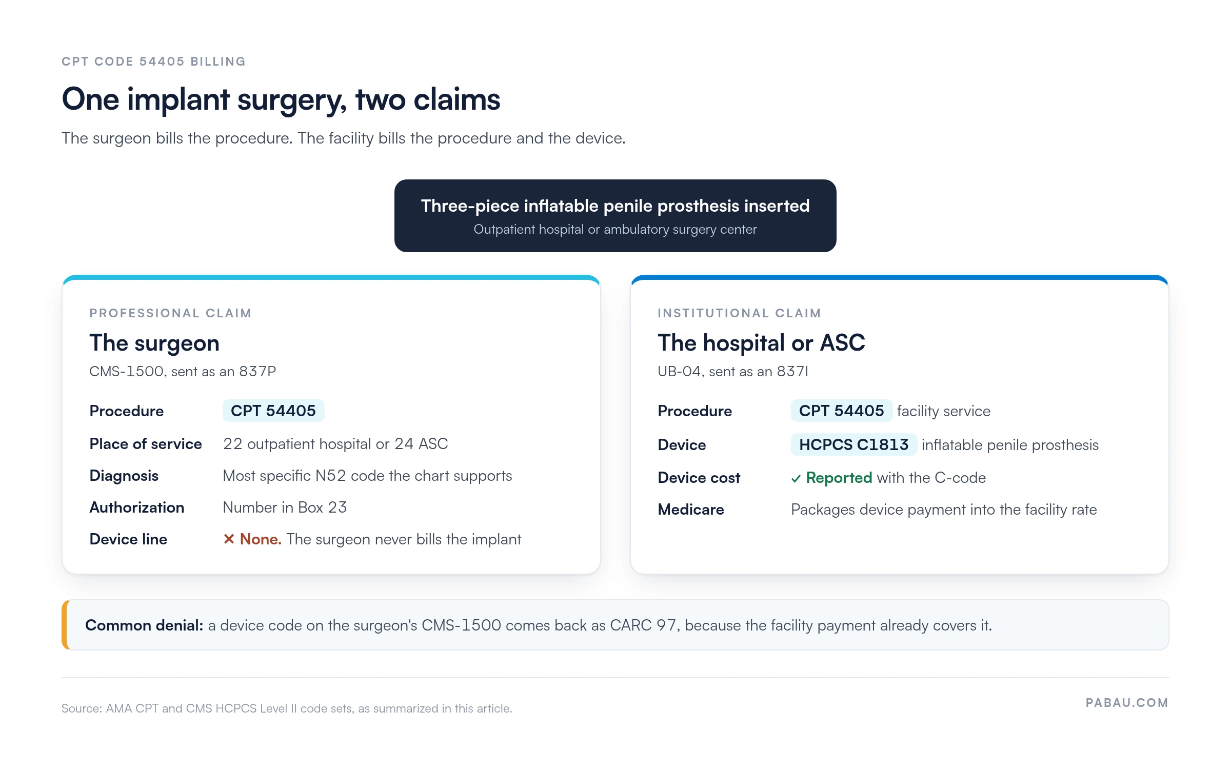 Diagram of one CPT 54405 surgery producing two claims