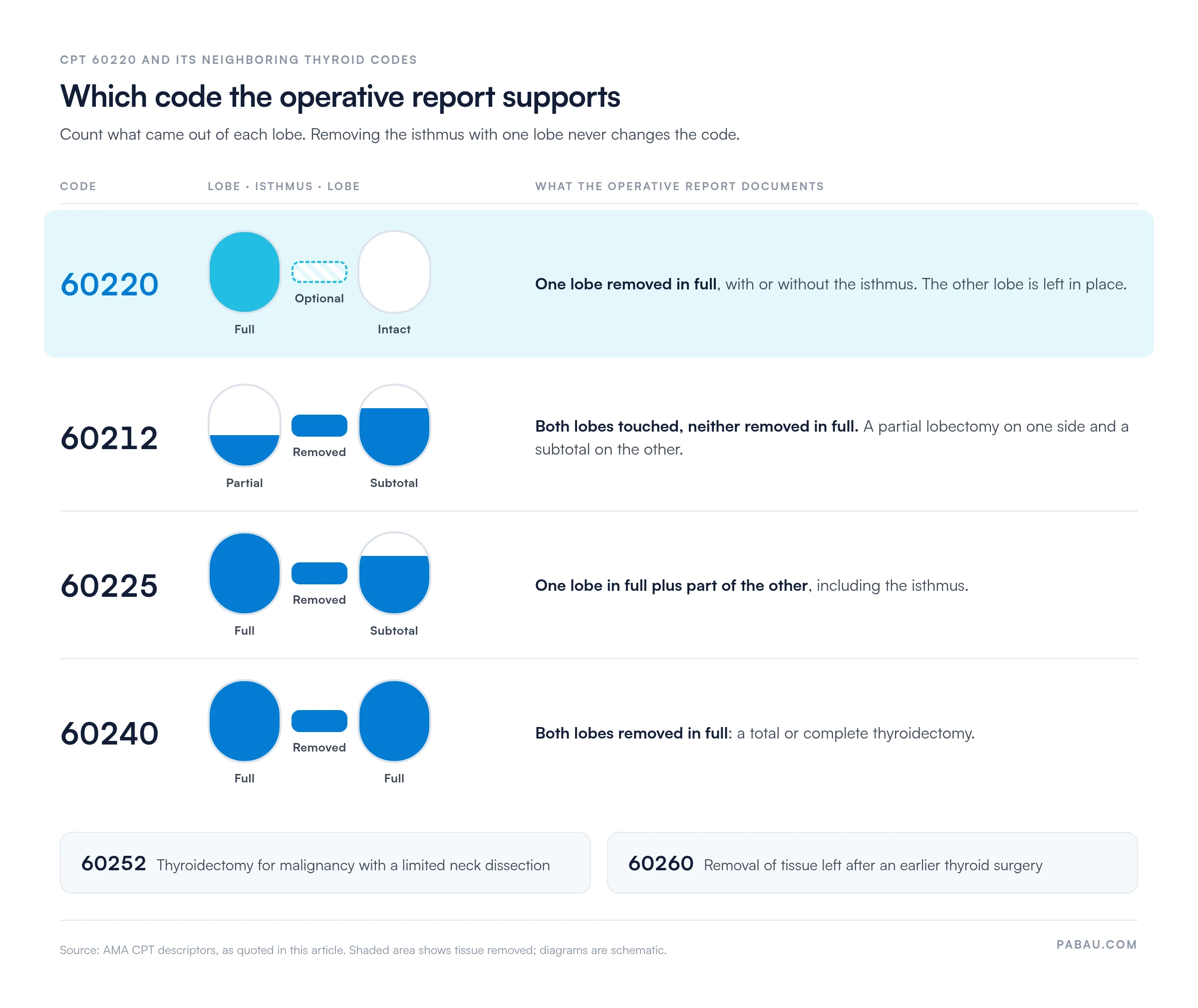 Decision chart of thyroid surgery codes by tissue removed: 60220 one lobe in full with isthmus optional and the other lobe intact; 60212 partial lobectomy plus contralateral subtotal; 60225 one full lobe plus contralateral subtotal; 60240 both lobes in full; also 60252 for malignancy with limited neck dissection and 60260 for completion surgery